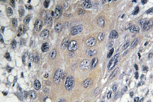 Polyclonal Rabbit anti-Human COPZ1 Antibody (Ile48, IHC, WB)