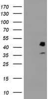 Monoclonal Mouse anti-Human PDSS2 / DLP1 Antibody (clone OTI1D2, IHC, WB)