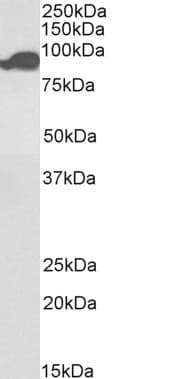 Polyclonal Goat anti-Human ACO2 / Aconitase 2 Antibody (Biotin, Internal Region, IHC, IF, WB)
