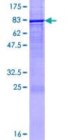 Human CYP2E1 Protein (Recombinant GST)
