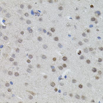 MYCN / N-myc Antibody