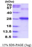 Human CEACAM7 Protein (Recombinant His)