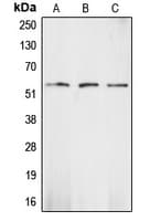 CHEK1 / CHK1 Antibody (Internal)