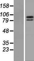 ZBTB39 Protein (Over-Expression Lysate Myc-DDK (Flag))