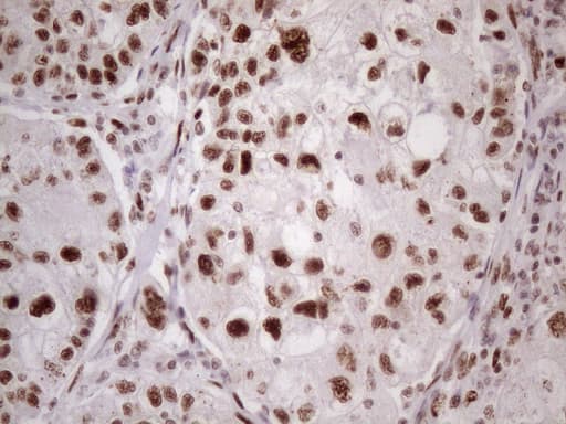 TP53BP1 / 53BP1 Antibody (aa1-300, clone OTI2H6)
