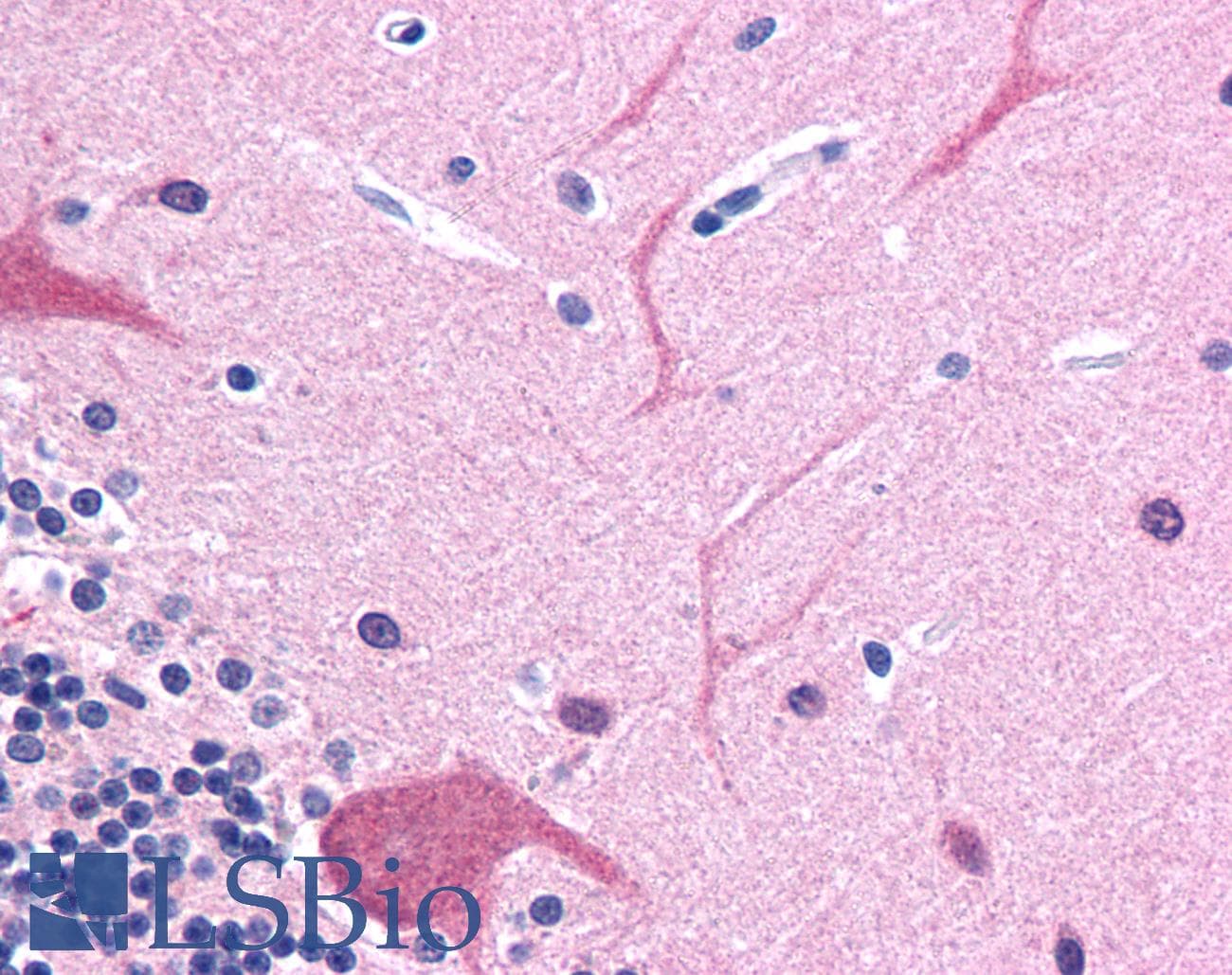 IHC-plus™ Monoclonal Mouse anti-Human TUBB3 / Tubulin Beta 3 Antibody (clone TU-20, C-Terminus, IHC, WB)