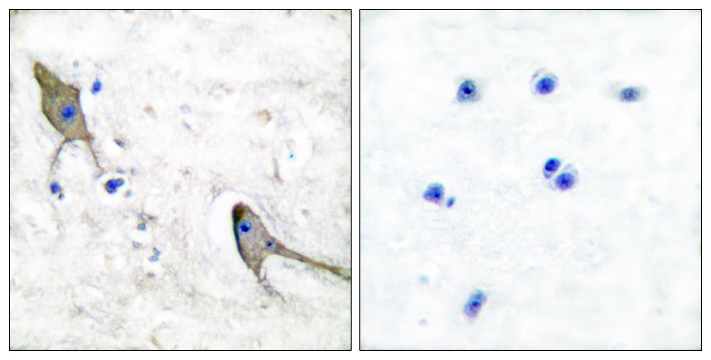 Polyclonal Rabbit anti-Human PTK2B / PYK2 Antibody (aa847-896, IHC, WB)