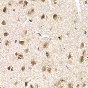 Polyclonal Rabbit anti-Human MCM4 Antibody (IHC, WB)