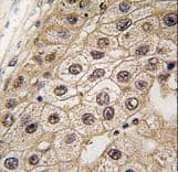Polyclonal Rabbit anti-Human EIF2AK3 / PERK Antibody (aa148-175, IHC, WB)