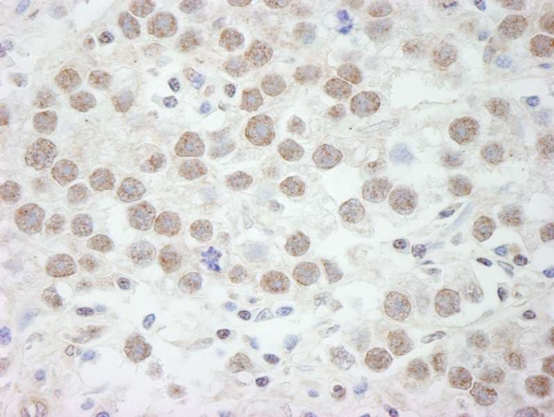 Polyclonal Rabbit anti-Human DDX17 Antibody (aa550-C-term, IHC)