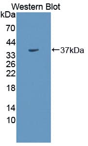 CA8 / Carbonic Anhydrase VIII Antibody (aa1-290)