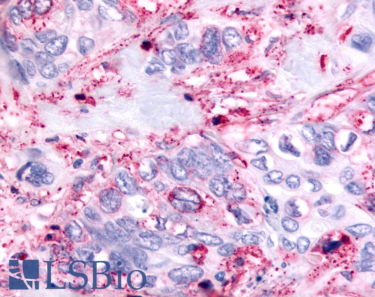 PathPlus™ PAK6 Antibody (Linker Domain)