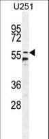 Polyclonal Rabbit anti-Human CCDC9 Antibody (aa19-48, WB)