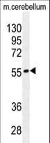 FAM69B Antibody (aa107-136)