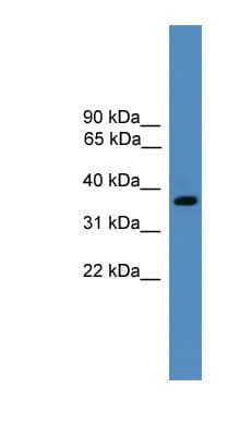 BSND / Barttin Antibody (aa211-260)