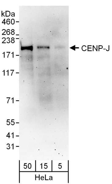 CENPJ / LAP Antibody (aa675-725)