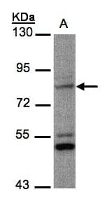 PHEX / PEX Antibody (aa1-355)