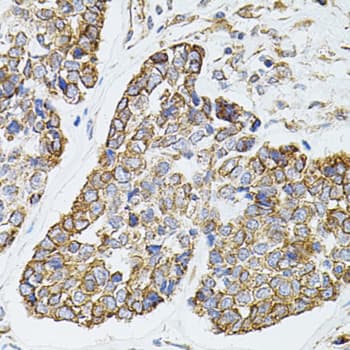 IHC-plus™ MTTP / MTP Antibody
