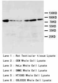 HSP90 / Heat Shock Protein 90 Antibody (aa676-693)