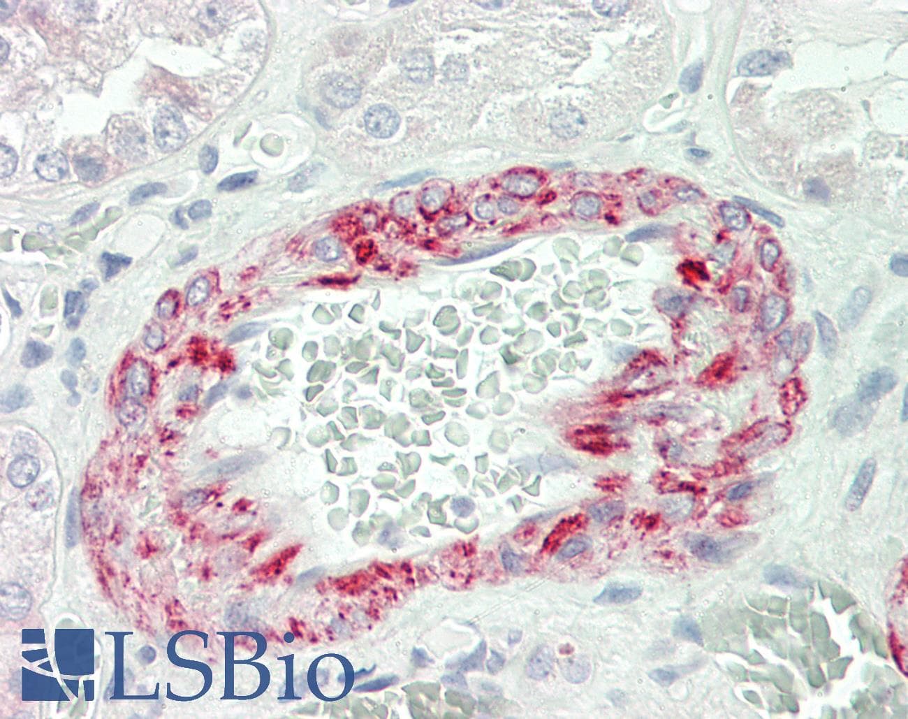 IHC-plus™ Polyclonal Rabbit anti-Human CDC42BPB / MRCKB Antibody (Phe1665, IHC, WB)