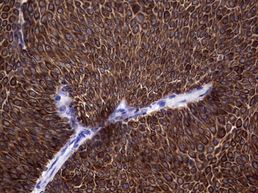 Monoclonal Mouse anti-Human KRT19 / CK19 / Cytokeratin 19 Antibody (clone OTI9A9, aa240-390, IHC)