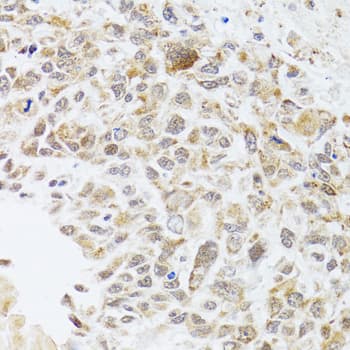 RNASEL / RNase L Antibody