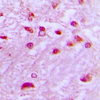 Polyclonal Rabbit anti-Human DYRK / DYRK1A Antibody (N-Terminus, IHC, IF, WB)