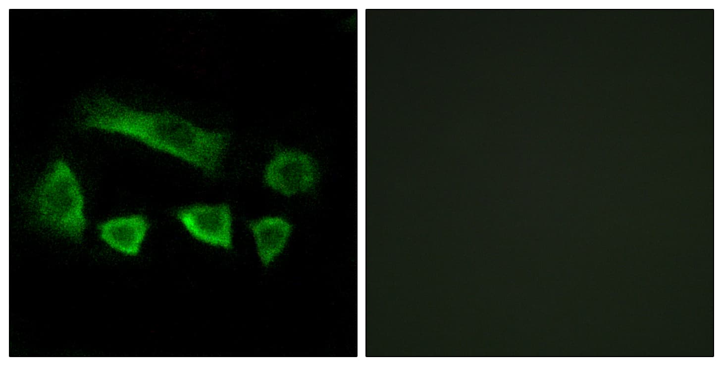 NT5C1B Antibody (aa171-220)