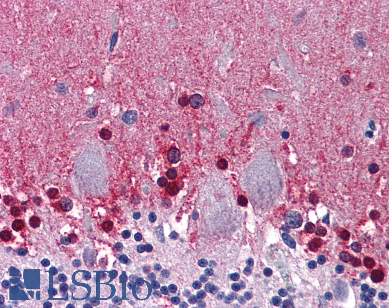 IHC-plus™ CBS Antibody (clone 5F7)