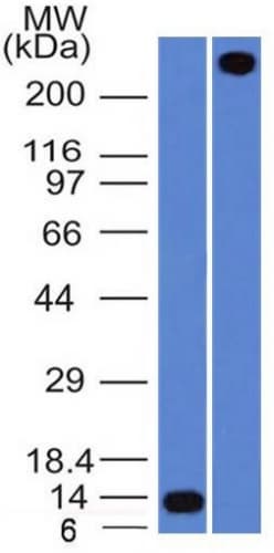 VWF / Von Willebrand Factor Antibody (aa1815-1939, clone rVWF/1465)