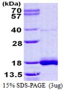 Human LSM3 Protein (Recombinant His)