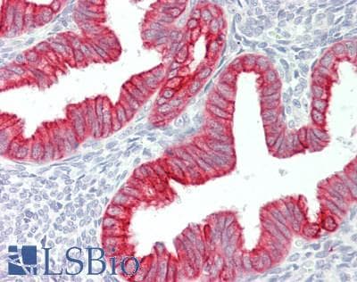 IHC-plus™ KRT8 / CK8 / Cytokeratin 8 Antibody (aa401-450)