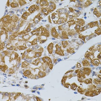 ASAH2 Antibody
