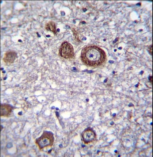 MAP1LC3B / LC3B Antibody (aa9-33)