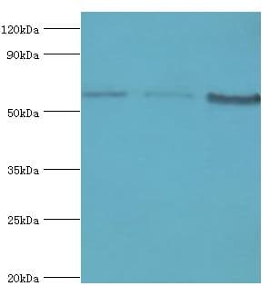 Polyclonal Rabbit anti-Human IL10RA Antibody (aa22-230, IHC, WB)