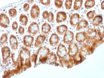 CTNNB1 / Beta Catenin Antibody (clone CTNNB1/1509)