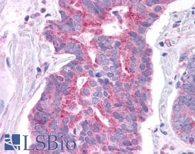 PathPlus™ Polyclonal Rabbit anti-Human GPER1 / GPR30 Antibody (C-Terminus, IHC, IF, WB)