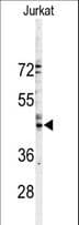 IHC-plus™ GJA3 / CX46 / Connexin 46 Antibody (aa108-139)