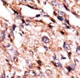 Polyclonal Rabbit anti-Human BCKDK Antibody (aa120-151, IHC, WB)