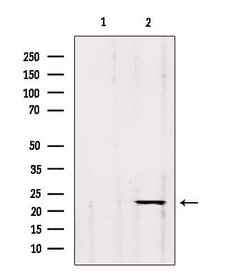 Polyclonal Rabbit anti-Human GP1BB / CD42c Antibody (IHC, WB)