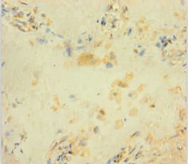 Polyclonal Rabbit anti-Human MYD118 / GADD45B Antibody (IHC, IF)
