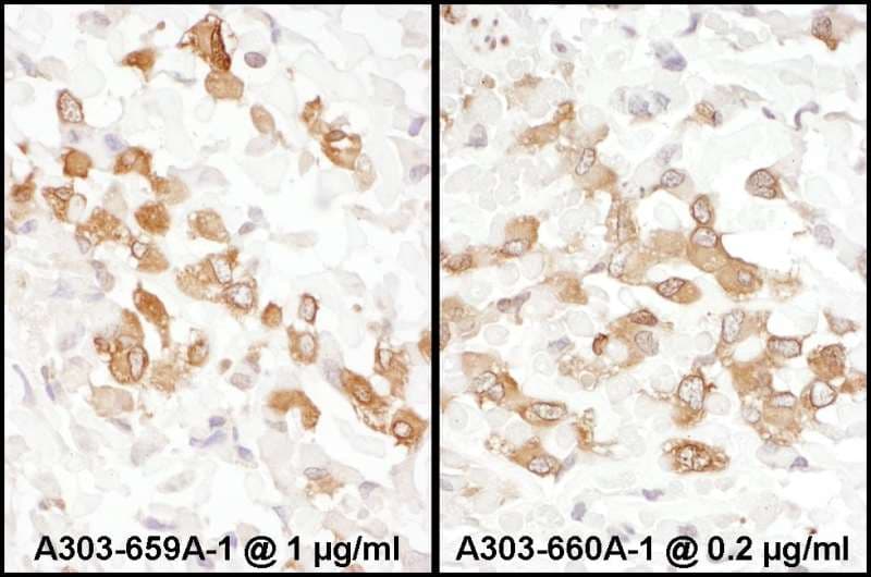 Polyclonal Rabbit anti-Human PKM / Pyruvate Kinase, Muscle Antibody (aa1-50, IHC, WB)