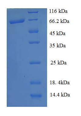 E. coli poxB Protein (Recombinant His)