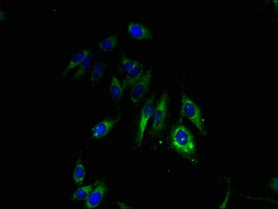 Polyclonal Rabbit anti-Human GJB3 / CX31 / Connexin 31 Antibody (aa211-270, IHC, WB)