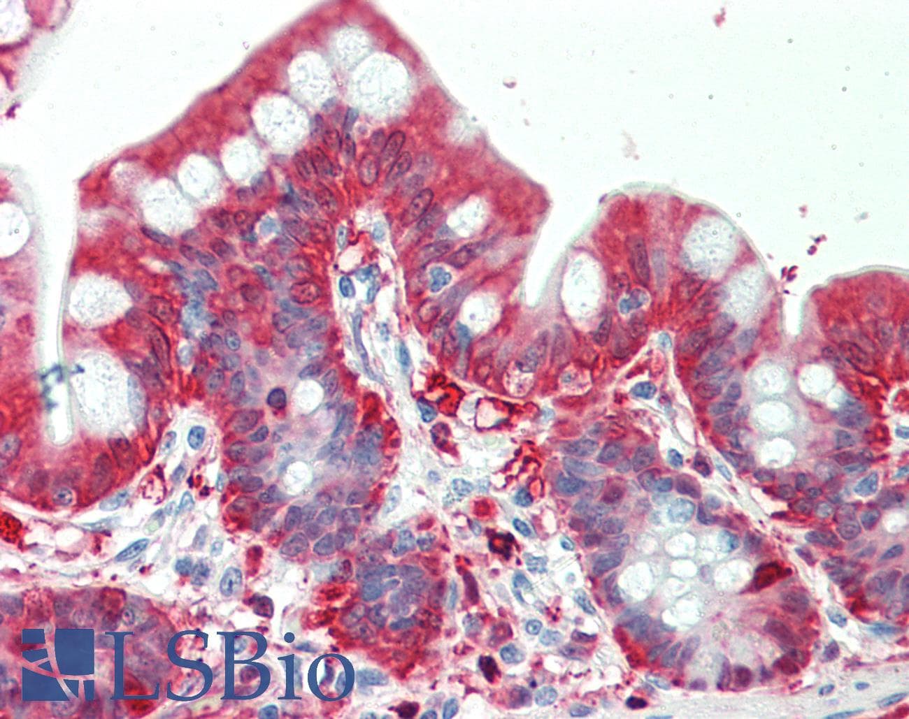 PathPlus™ Monoclonal Mouse anti-Human ALDH1A1 / ALDH1 Antibody (clone 5A11, IHC, WB)