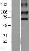 DISC1 Protein (Over-Expression Lysate Myc-DDK (Flag))