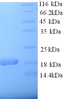 Rat A2M / Alpha-2-Macroglobulin Protein (Recombinant His)