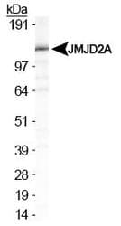 KDM4A / JHDM3A / JMJD2A Antibody (aa320-460)
