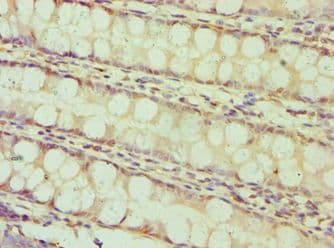 Polyclonal Rabbit anti-Human BAMBI Antibody (aa21-152, IHC)