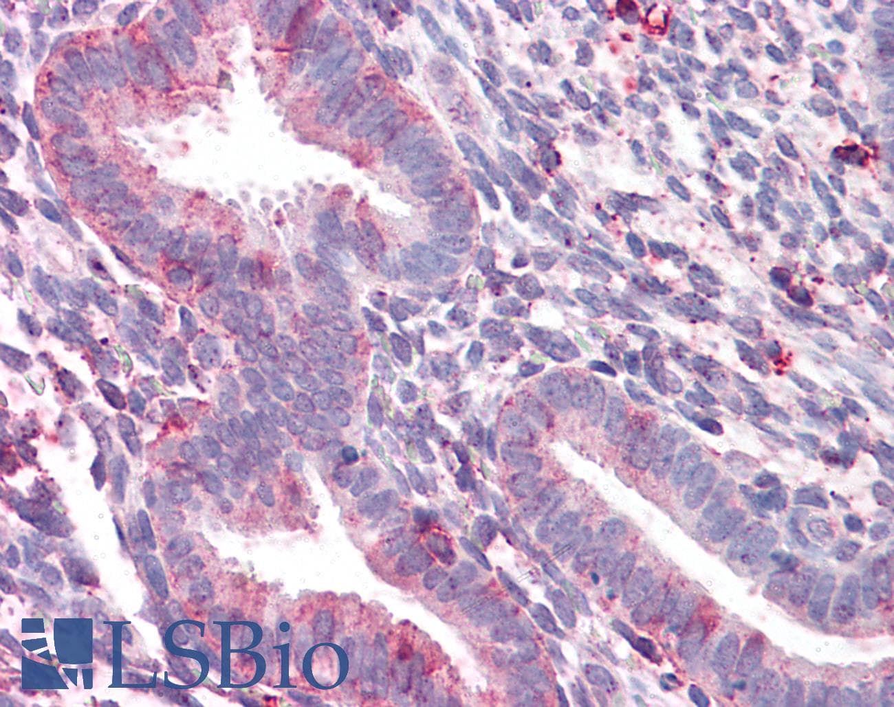 IHC-plus™ STEAP2 Antibody (C-Terminus)